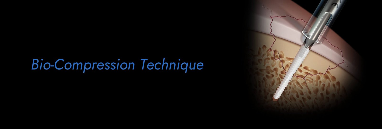 Bio-Compression-Technique-scaled.jpg