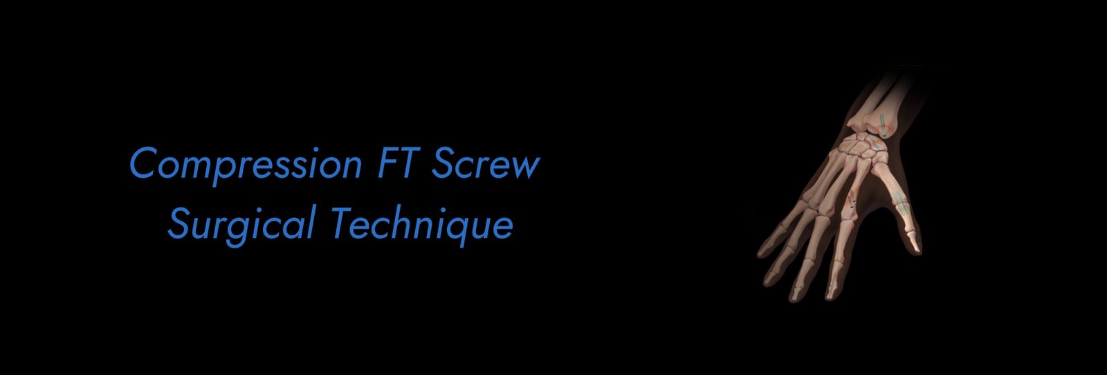 Compression-FT-Screw-Surgical-Technique-scaled.jpg