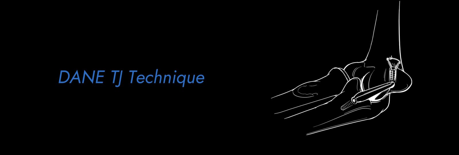 DANE-TJ-Technique-scaled.jpg