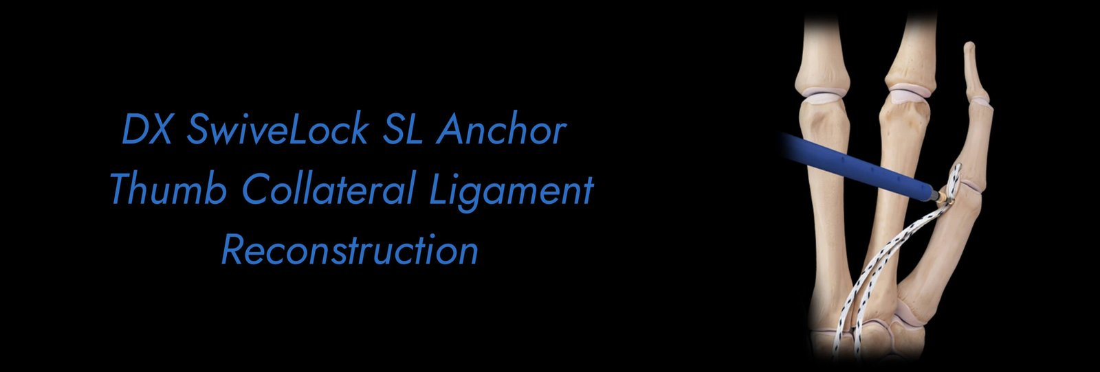 DX-SwiveLock-SL-Anchor-Thumb-Collateral-Ligament-Reconstruction-scaled.jpg