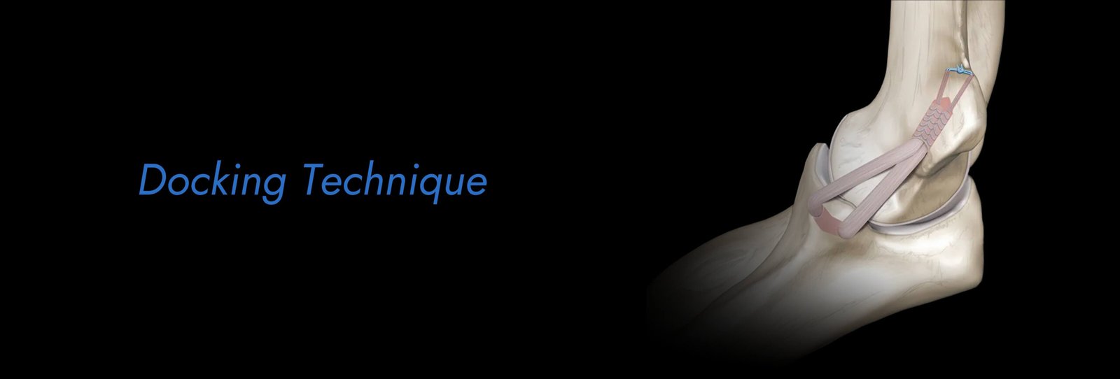 Docking-Technique-scaled.jpg