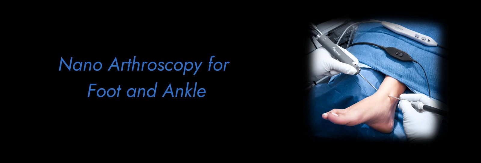 Nano-Arthroscopy-for-Foot-and-Ankle-scaled.jpg
