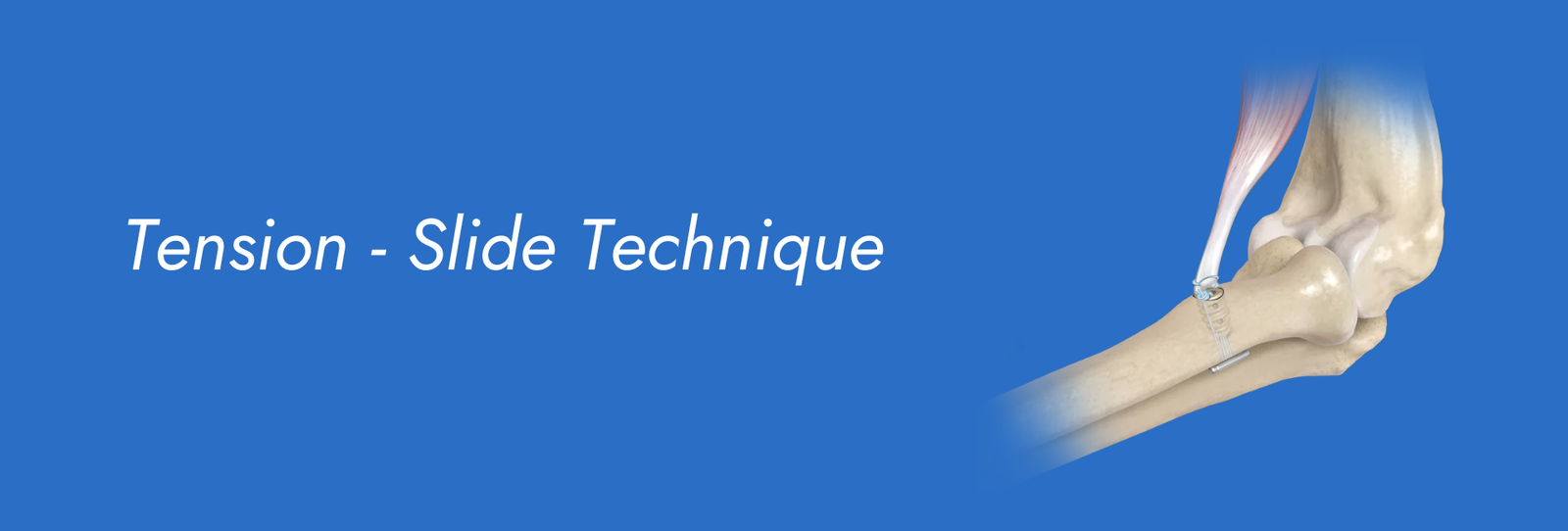 Tension-Slide-Technique.png