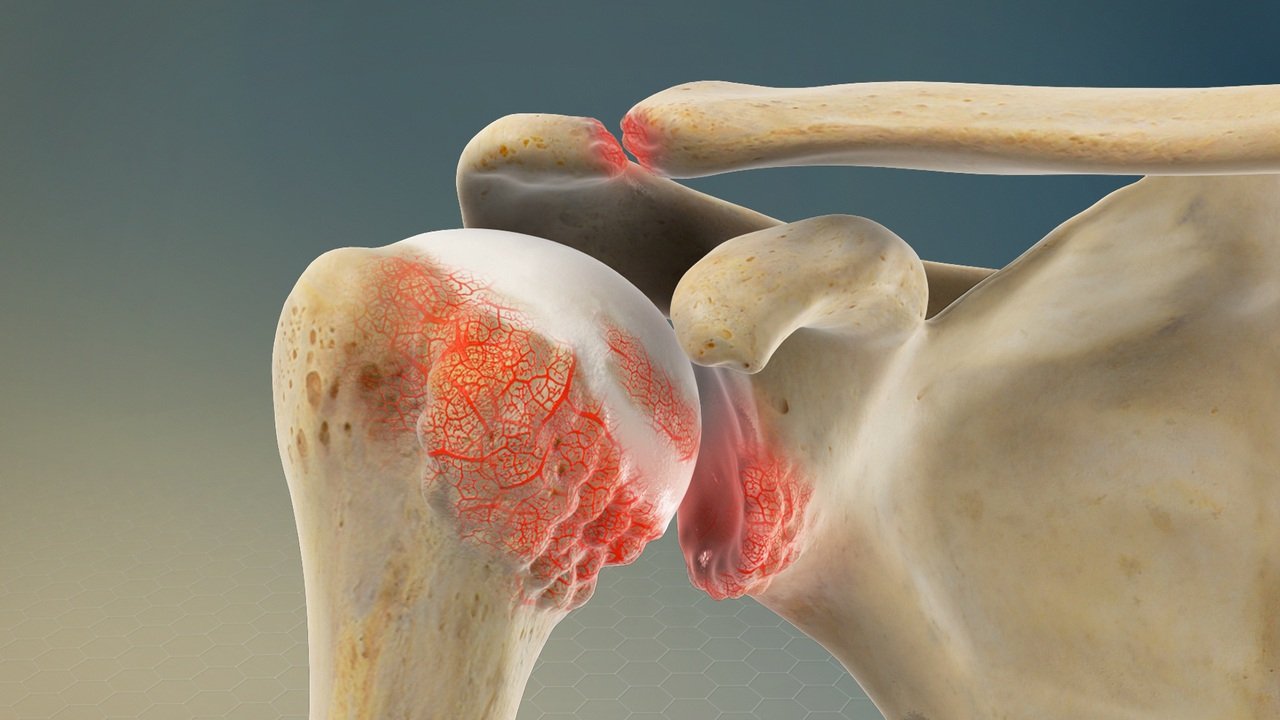 Best Acromioclavicular Joint Repair Doctors in Pune