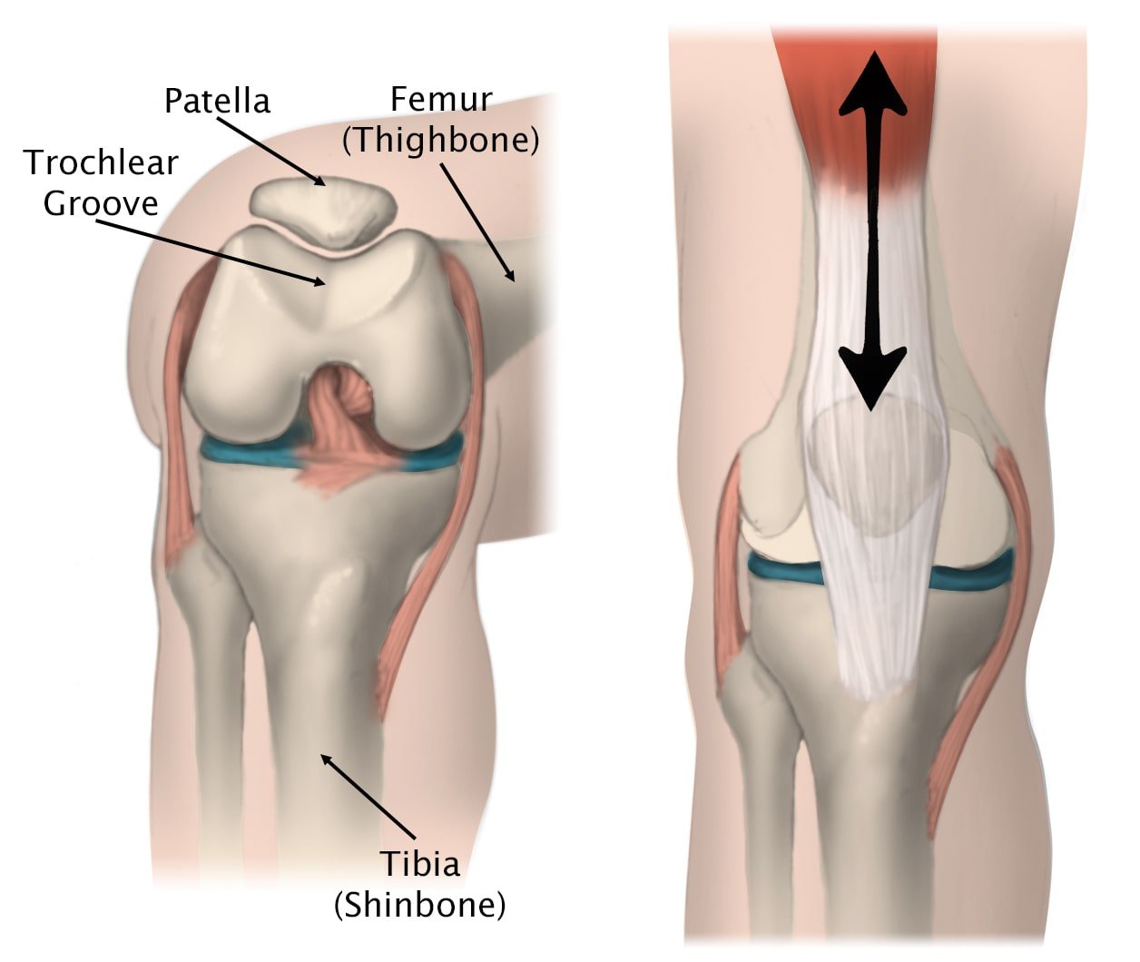 Lateral Patellar Compression Syndrome Treatment in Pune