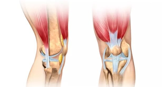 Microfracture Surgery for Cartilage Repair in the Knee